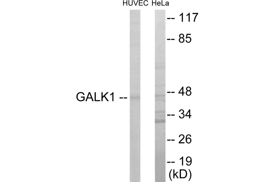 Western Blot - GALK1 Cell Based ELISA Kit (CB5907) - Antibodies.com