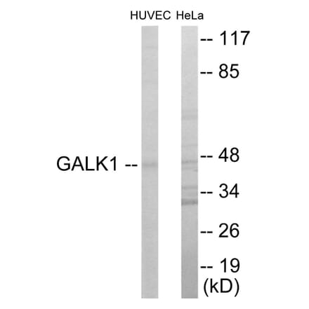 Western Blot - GALK1 Cell Based ELISA Kit (CB5907) - Antibodies.com