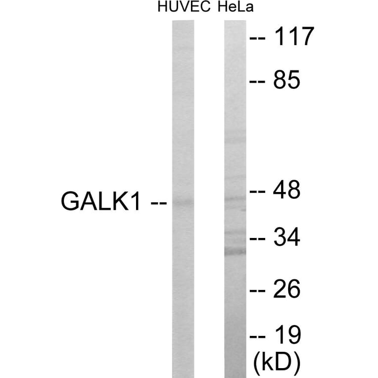 Western Blot - GALK1 Cell Based ELISA Kit (CB5907) - Antibodies.com