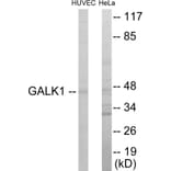 Western Blot - GALK1 Cell Based ELISA Kit (CB5907) - Antibodies.com