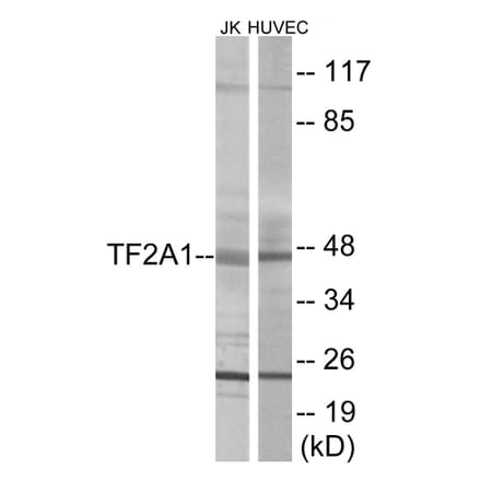 Western Blot - TF2A1 Cell Based ELISA Kit (CB5915) - Antibodies.com