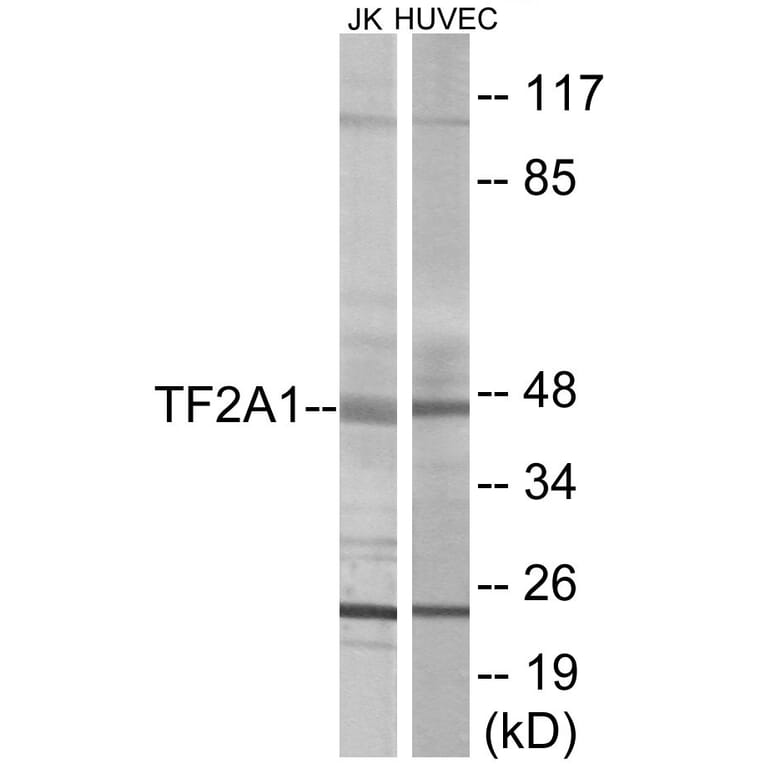 Western Blot - TF2A1 Cell Based ELISA Kit (CB5915) - Antibodies.com