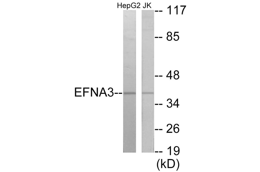 Western Blot - EFNA3 Cell Based ELISA Kit (CB5919) - Antibodies.com