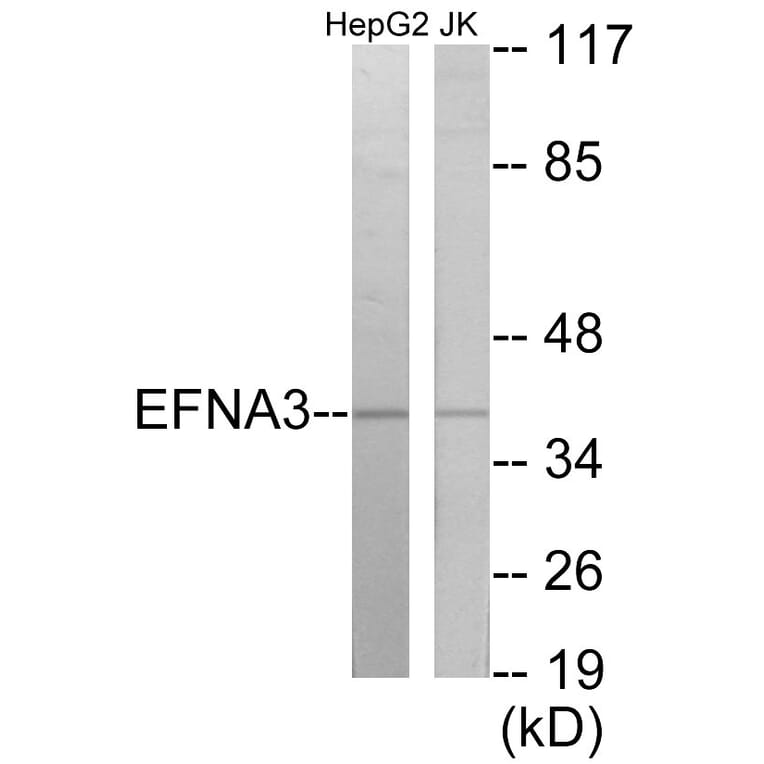 Western Blot - EFNA3 Cell Based ELISA Kit (CB5919) - Antibodies.com