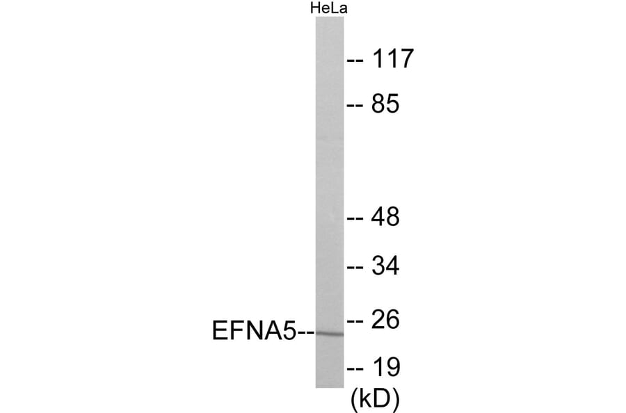 Western Blot - EFNA5 Cell Based ELISA Kit (CB5920) - Antibodies.com