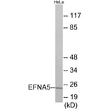 Western Blot - EFNA5 Cell Based ELISA Kit (CB5920) - Antibodies.com