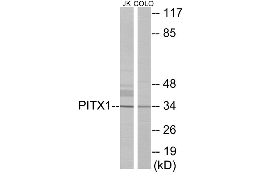 Western Blot - PITX1 Cell Based ELISA Kit (CB5937) - Antibodies.com