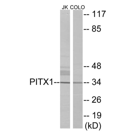 Western Blot - PITX1 Cell Based ELISA Kit (CB5937) - Antibodies.com