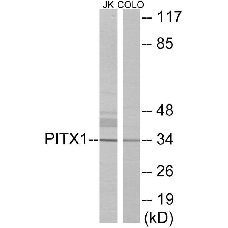 Western Blot - PITX1 Cell Based ELISA Kit (CB5937) - Antibodies.com