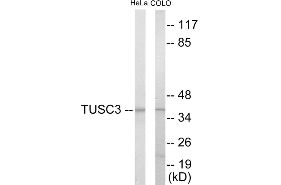Western Blot - TUSC3 Cell Based ELISA Kit (CB5989) - Antibodies.com