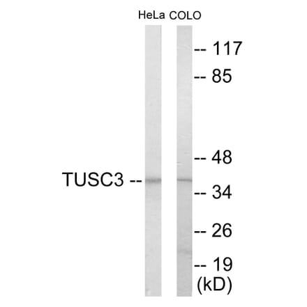 Western Blot - TUSC3 Cell Based ELISA Kit (CB5989) - Antibodies.com