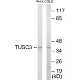 Western Blot - TUSC3 Cell Based ELISA Kit (CB5989) - Antibodies.com