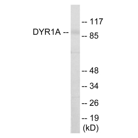 Western Blot - DYR1A Cell Based ELISA Kit (CB5998) - Antibodies.com