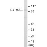 Western Blot - DYR1A Cell Based ELISA Kit (CB5998) - Antibodies.com