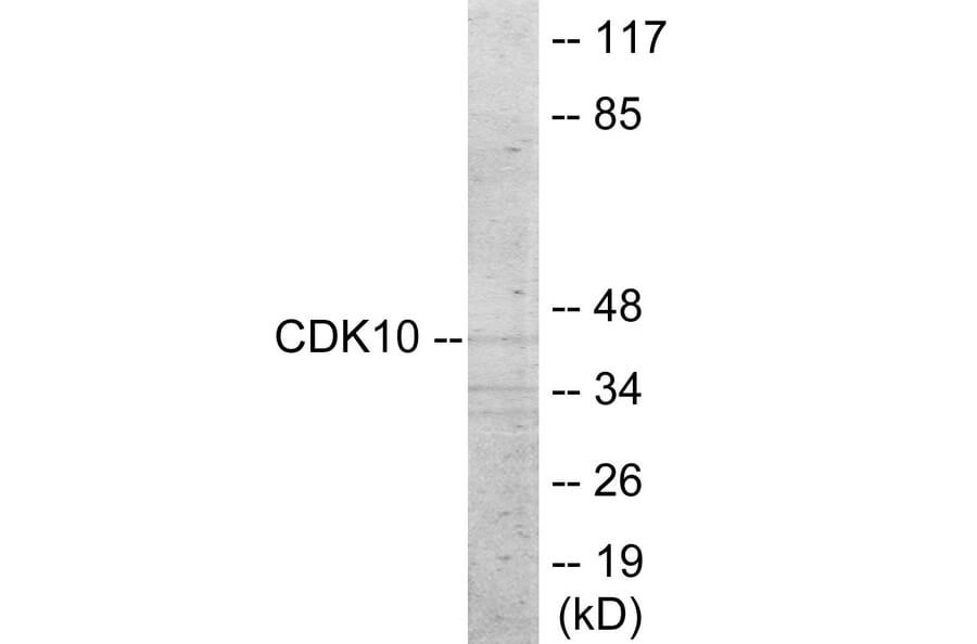 Western Blot - CDK10 Cell Based ELISA Kit (CB6014) - Antibodies.com