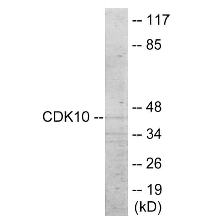 Western Blot - CDK10 Cell Based ELISA Kit (CB6014) - Antibodies.com