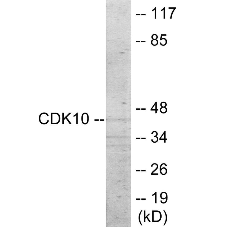 Western Blot - CDK10 Cell Based ELISA Kit (CB6014) - Antibodies.com