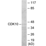 Western Blot - CDK10 Cell Based ELISA Kit (CB6014) - Antibodies.com