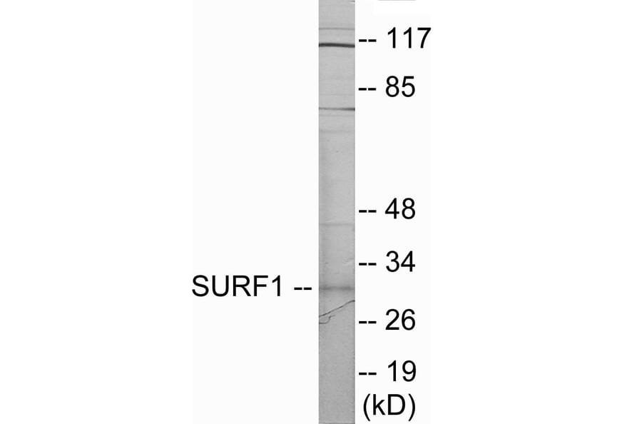 Western Blot - SURF1 Cell Based ELISA Kit (CB6019) - Antibodies.com