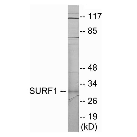 Western Blot - SURF1 Cell Based ELISA Kit (CB6019) - Antibodies.com