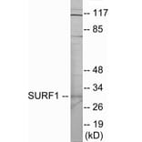 Western Blot - SURF1 Cell Based ELISA Kit (CB6019) - Antibodies.com