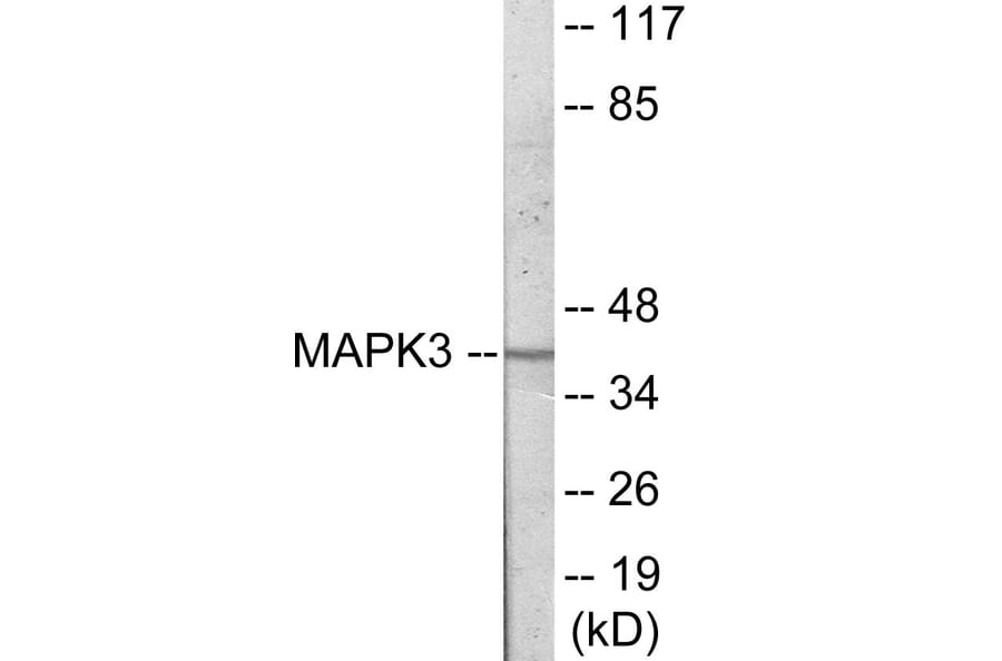 Western Blot - MAPK3 Cell Based ELISA Kit (CB6037) - Antibodies.com