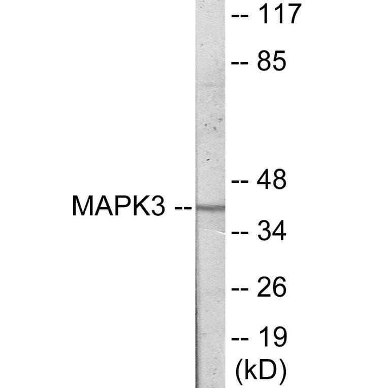 Western Blot - MAPK3 Cell Based ELISA Kit (CB6037) - Antibodies.com