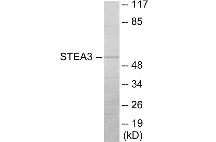 Western Blot - STEA3 Cell Based ELISA Kit (CB6060) - Antibodies.com