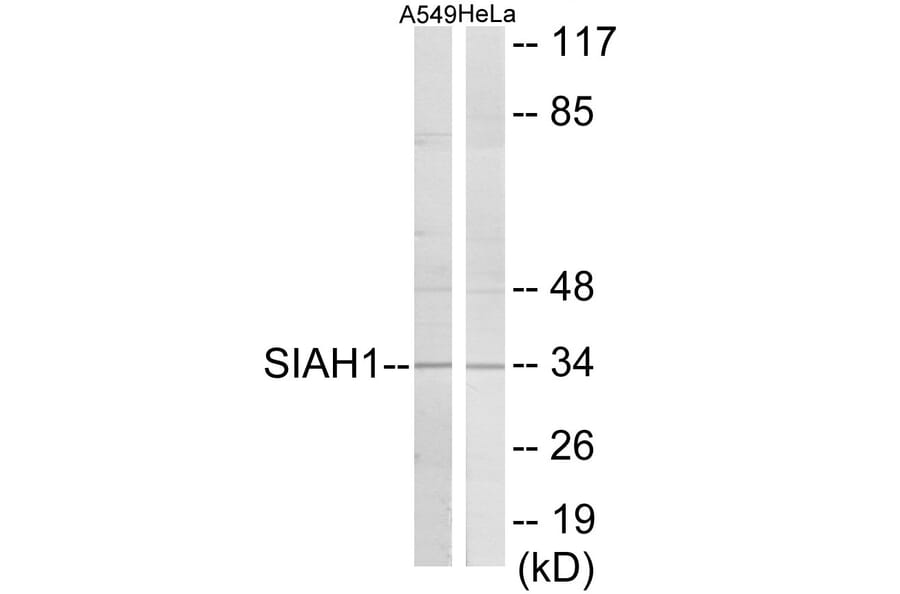 Western Blot - SIAH1 Cell Based ELISA Kit (CB6074) - Antibodies.com