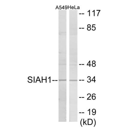 Western Blot - SIAH1 Cell Based ELISA Kit (CB6074) - Antibodies.com