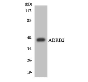 Western Blot - ADRB2 Cell Based ELISA Kit (CB6147) - Antibodies.com