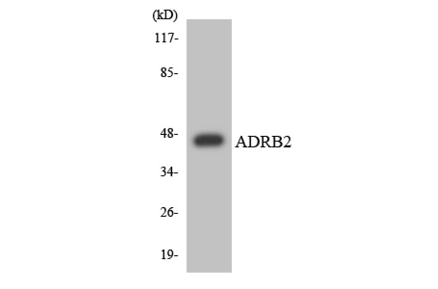 Western Blot - ADRB2 Cell Based ELISA Kit (CB6147) - Antibodies.com