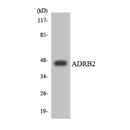 Western Blot - ADRB2 Cell Based ELISA Kit (CB6147) - Antibodies.com