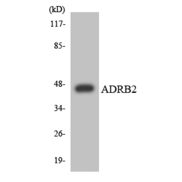 Western Blot - ADRB2 Cell Based ELISA Kit (CB6147) - Antibodies.com