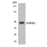 Western Blot - ADRB2 Cell Based ELISA Kit (CB6147) - Antibodies.com