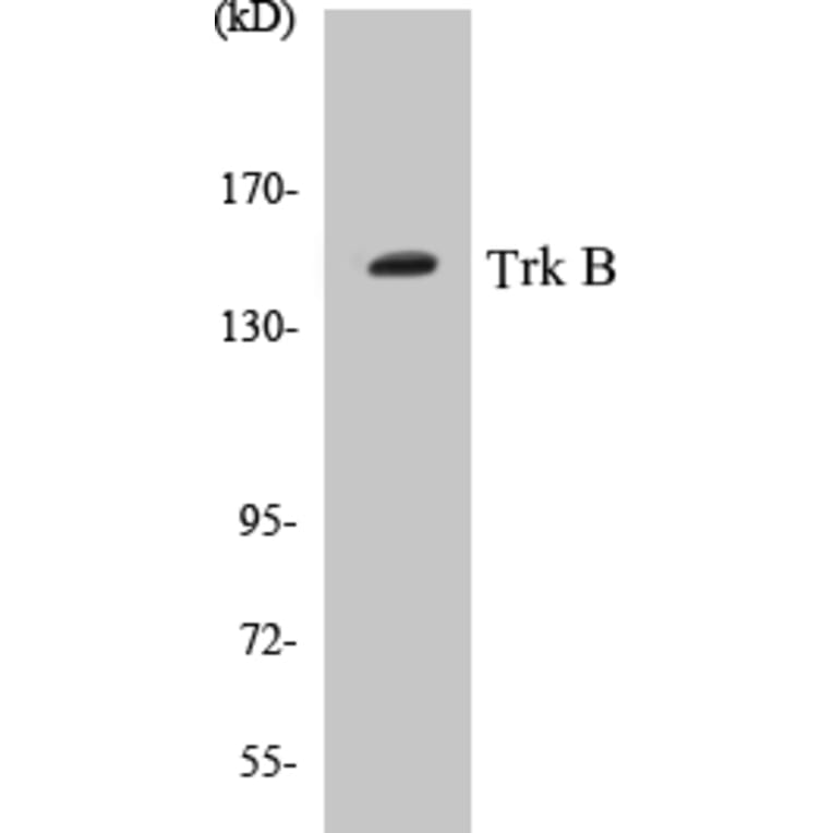 Western Blot - TrkB Cell Based ELISA Kit (CB5704) - Antibodies.com