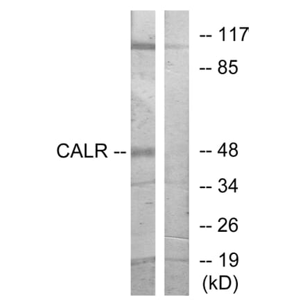 Western Blot - CALR Cell Based ELISA Kit (CB5868) - Antibodies.com