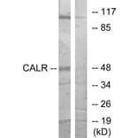 Western Blot - CALR Cell Based ELISA Kit (CB5868) - Antibodies.com