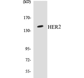 Western Blot - HER2 Cell Based ELISA Kit (CB5329) - Antibodies.com