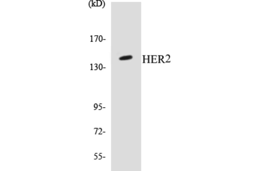Western Blot - HER2 Cell Based ELISA Kit (CB5329) - Antibodies.com