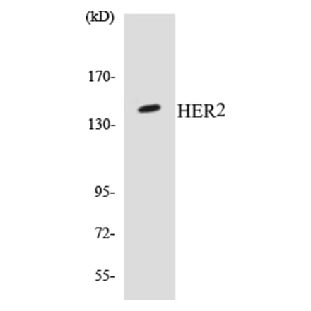 Western Blot - HER2 Cell Based ELISA Kit (CB5329) - Antibodies.com