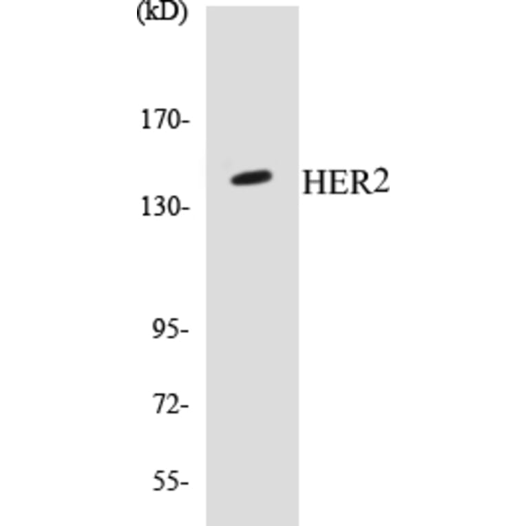 Western Blot - HER2 Cell Based ELISA Kit (CB5329) - Antibodies.com