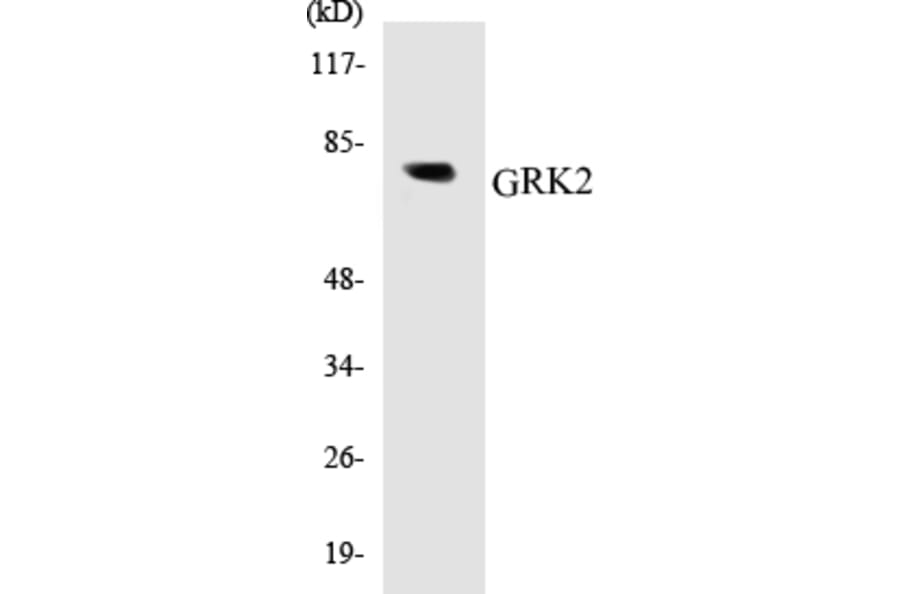 Western Blot - GRK2 Cell Based ELISA Kit (CB5306) - Antibodies.com