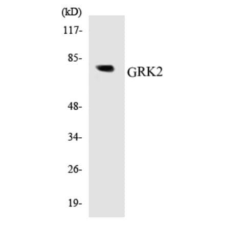 Western Blot - GRK2 Cell Based ELISA Kit (CB5306) - Antibodies.com