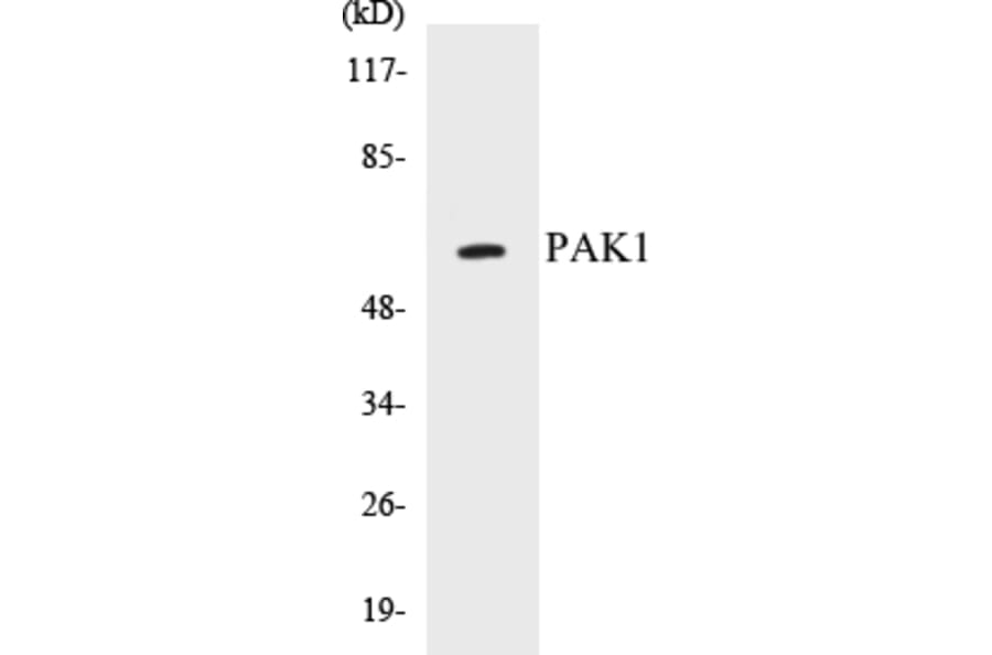 Western Blot - PAK1 Cell Based ELISA Kit (CB5528) - Antibodies.com