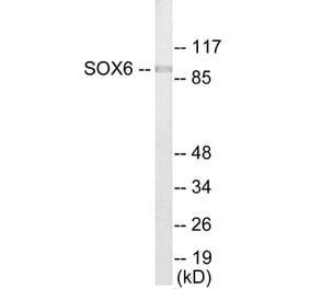 Western Blot - SOX6 Cell Based ELISA Kit (CB5883) - Antibodies.com