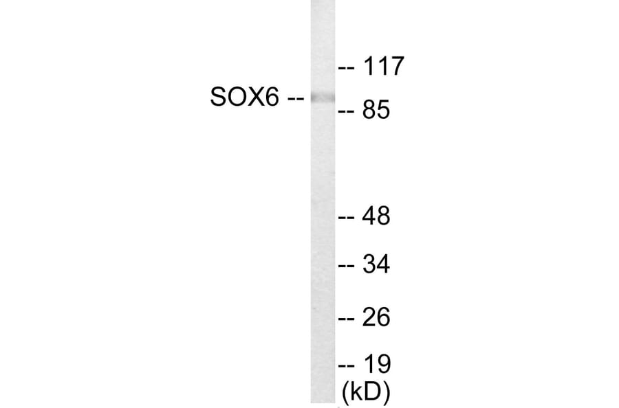 Western Blot - SOX6 Cell Based ELISA Kit (CB5883) - Antibodies.com
