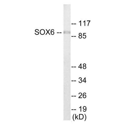 Western Blot - SOX6 Cell Based ELISA Kit (CB5883) - Antibodies.com