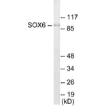 Western Blot - SOX6 Cell Based ELISA Kit (CB5883) - Antibodies.com