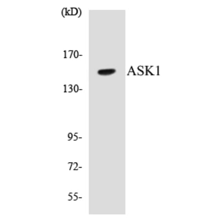 Western Blot - ASK1 Cell Based ELISA Kit (CB5050) - Antibodies.com